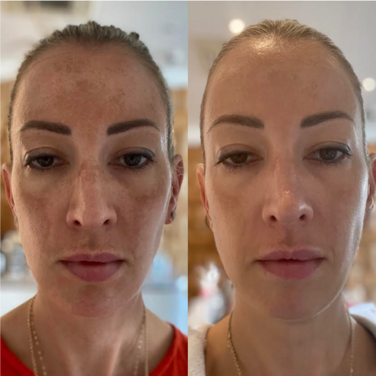 NanoFusion Facial 1.png