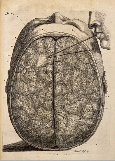 Brain 1744 / Wellcome Images