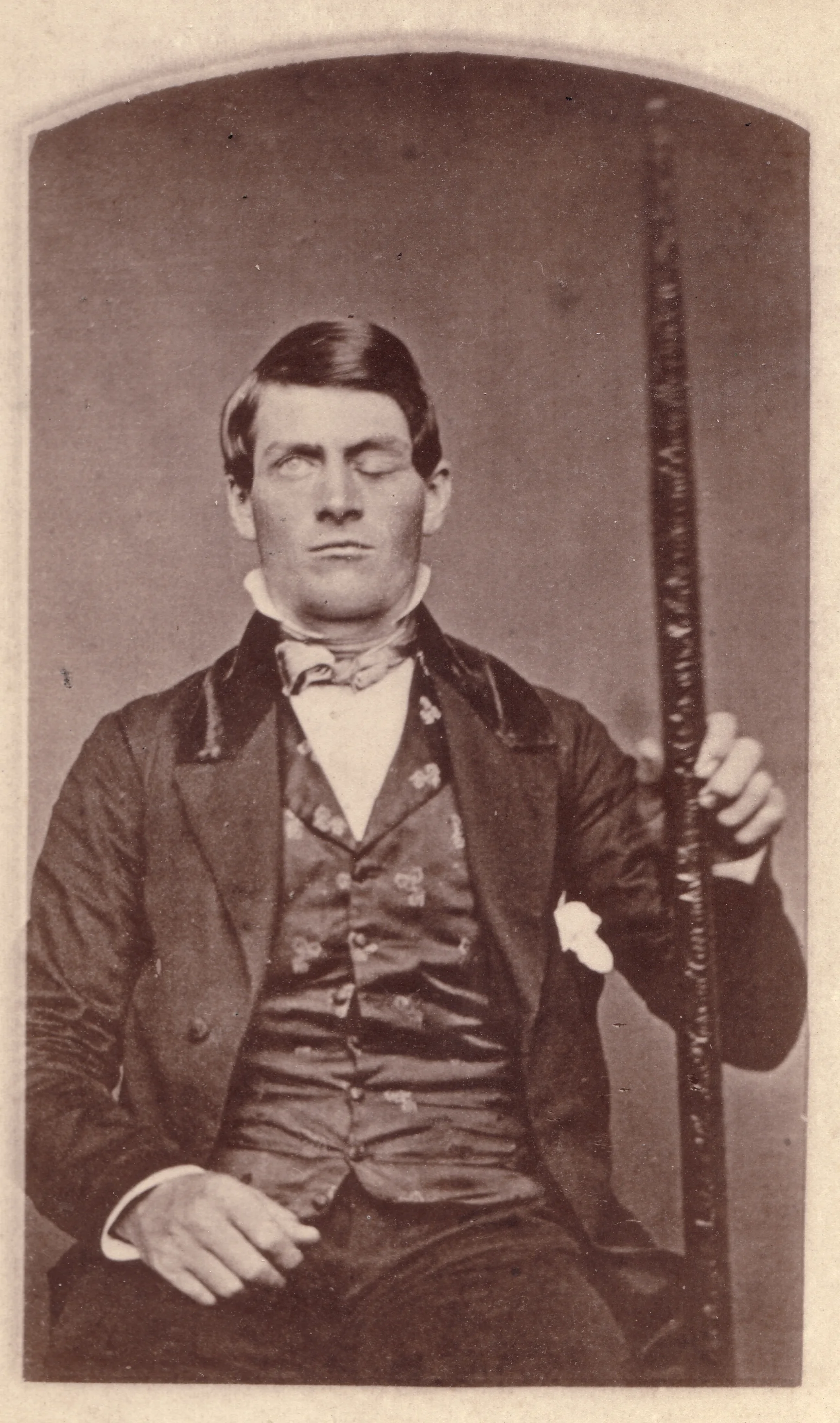 Phineas Gage / Unknown Photographer