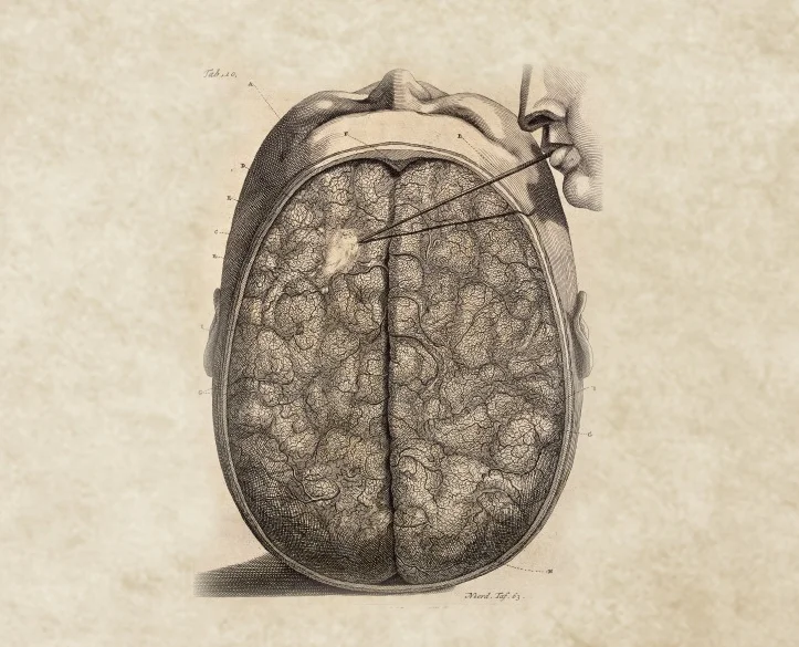 Creepy / Wellcome Images