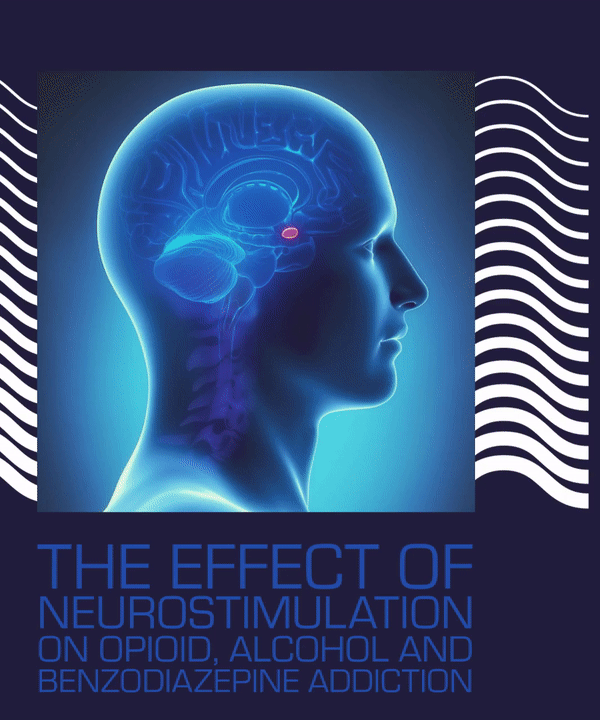 The Effect of Neurostimulation on Opioid, Alcohol and Benzodiazepine Addiction
