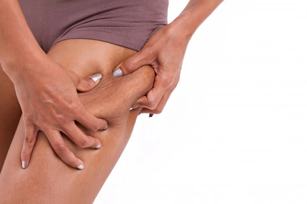 woman-s-hand-holding-excessive-leg-fat-or-cellulite_46728-85.jpg