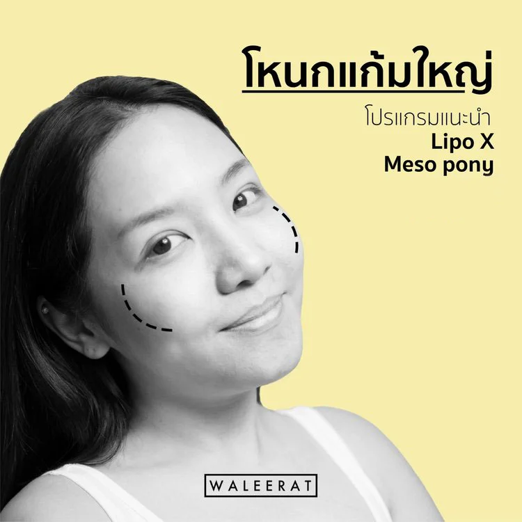 8+จุดยอดฮิต+สลายไขมันไม่ศัลยกรรม.jpg