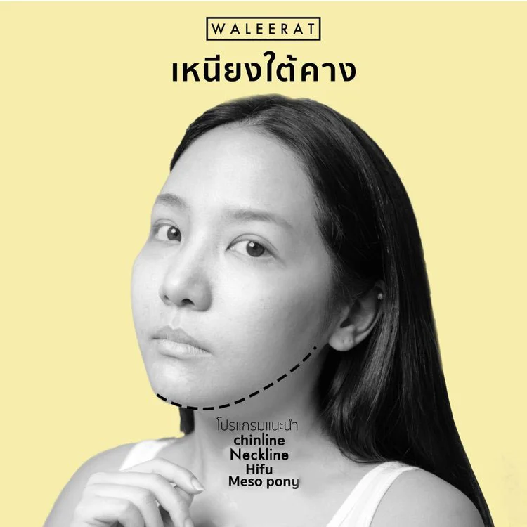 จุดยอดฮิต+สลายไขมันไม่ศัลยกรรม.jpg