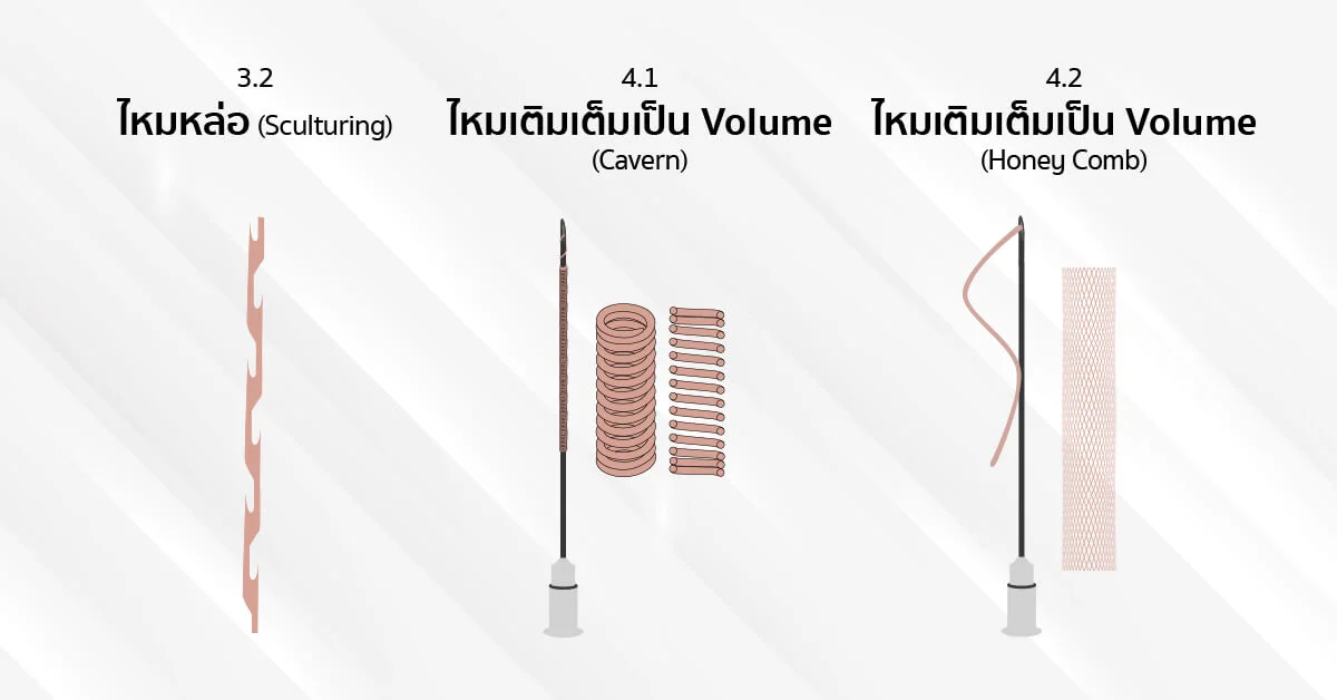 ลักษณะประเภทไหม