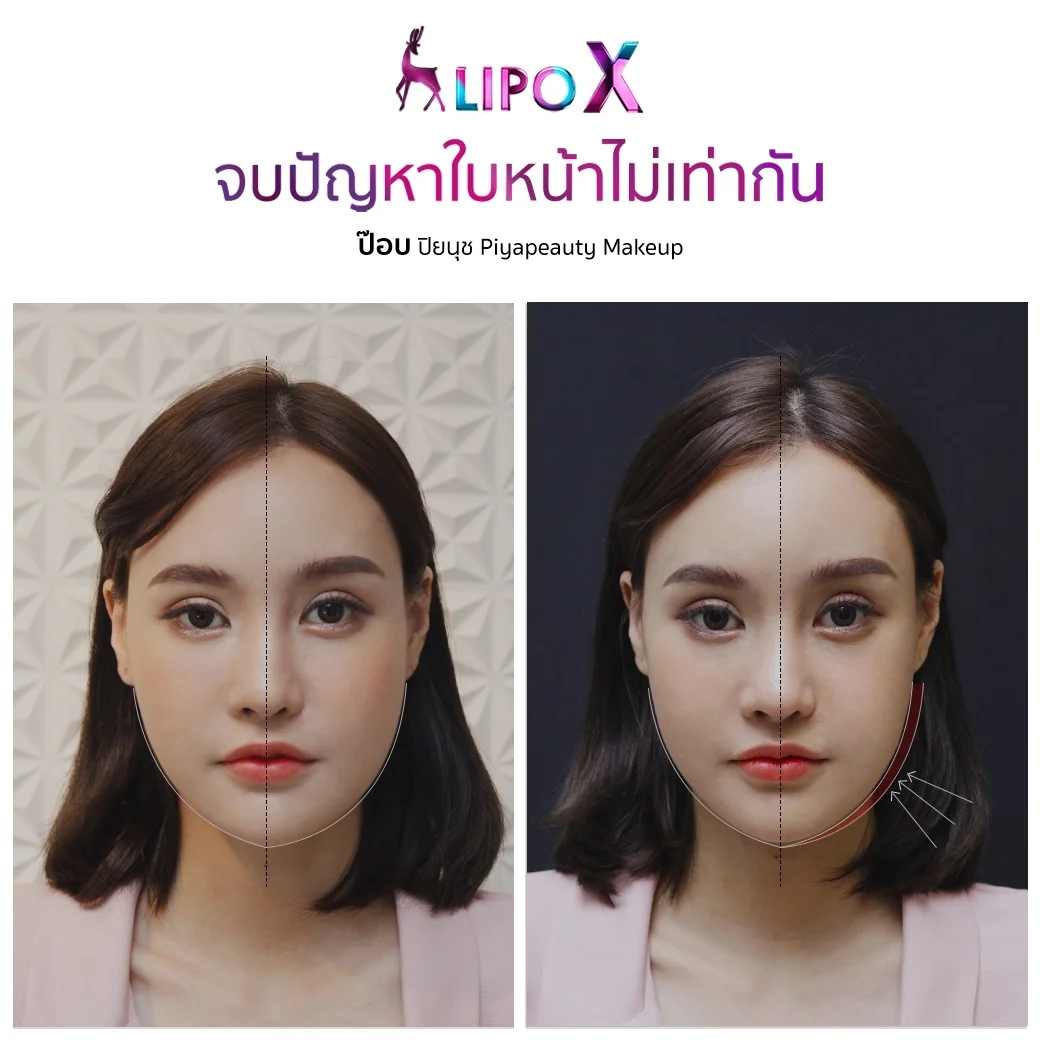 ร้อยไหม รีวิว