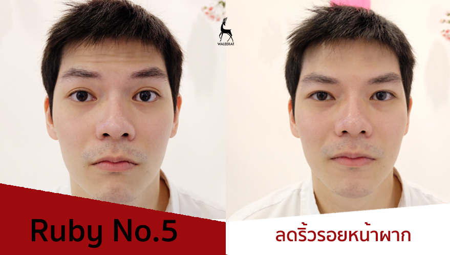 Ruby+หมอกลาง.jpg