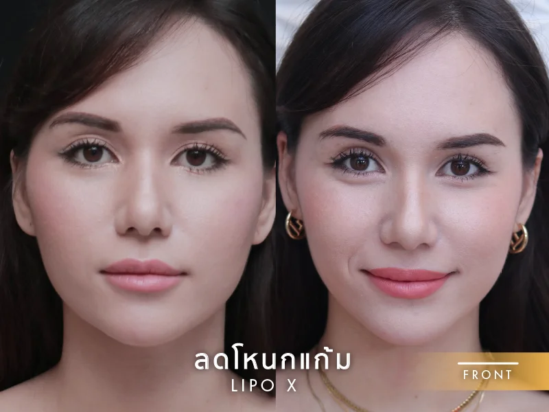 logo นอน