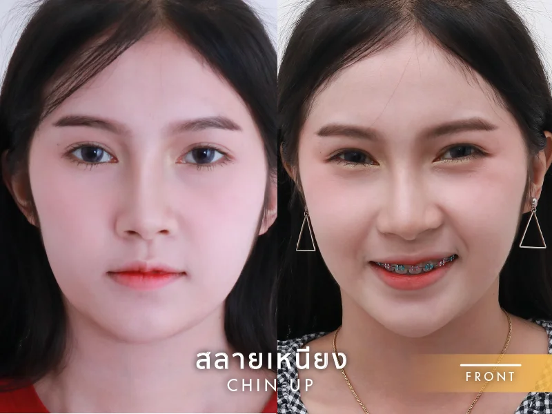 logo นอน