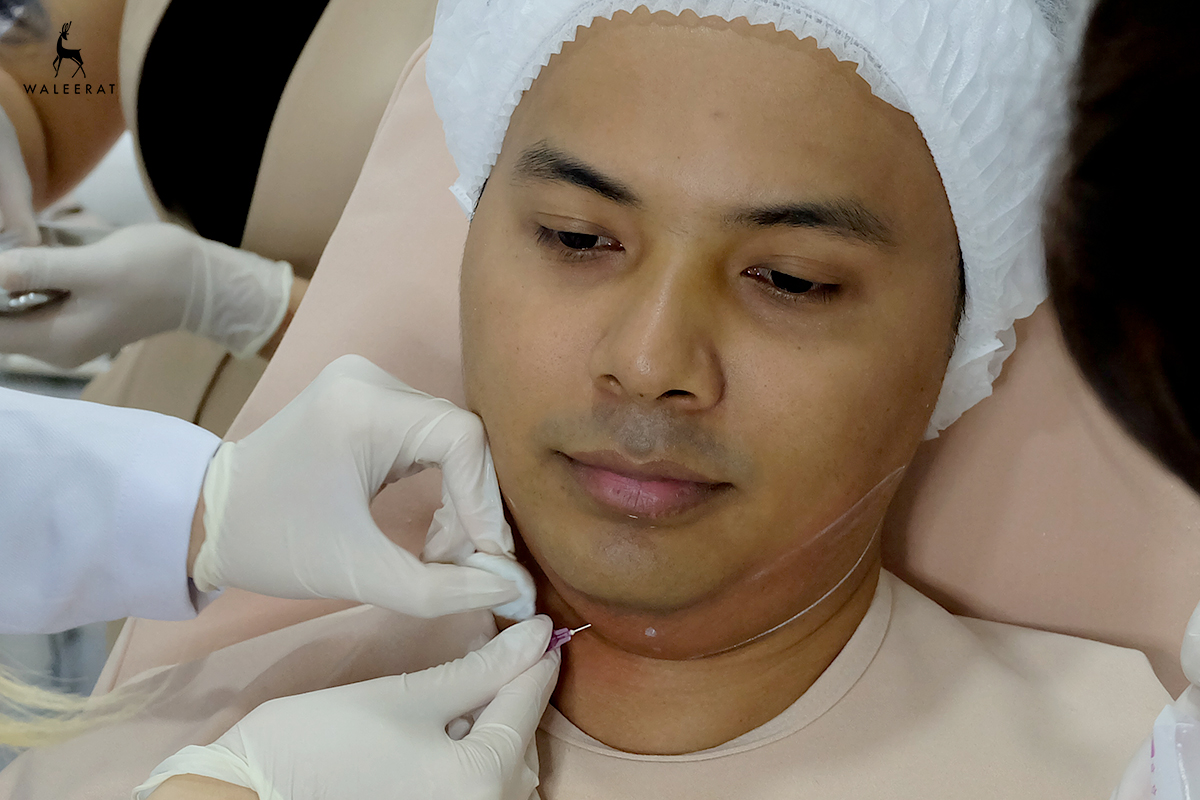 Review-Chin-Up-คุณชอว์-04.jpg