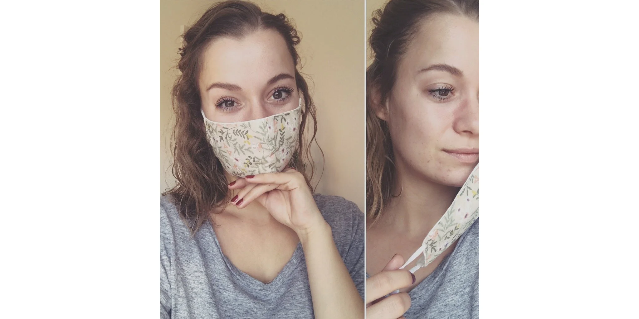 Pourquoi j'ai de l'acné sous mon masque et comment prévenir le maskné?