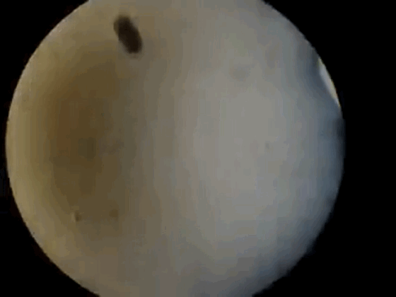Microscopic image of planulae raised from the cauliflower coral spawning in Kahalu'u Bay, May 2018.