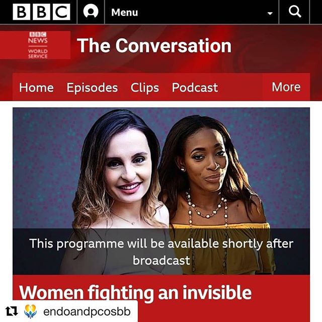 #Repost @endoandpcosbb with @get_repost
ใปใปใป
We invite you to tune into this @bbc world service interview featuring our co-founder Julia Mandeville (@julia_mandeville ) and @carineboustani93. Julia shares some of her personal story with Endometriosis and about the work we at the Barbados Association of Endometriosis and PCOS. , working as a collective, have been doing.
We thank the BBC for this global platform that will help us to raise more awareness and we are happy that it allowed us to meet a new advocacy partner with @undo_endo !
We do have two points to make before you listen:
1. Endometriosis is defined as when cells *similar* to those of the endometrium are found elsewhere in the body and
2. the Barbados Association of Endometriosis and PCOS was founded in 2016 not 2015. ๐
Link in bio ๐ค
#endometriosisawareness
#endoawareness
#endoadvocates
#endometriosis
#womenshealth
#womenempoweringwomen
#barbados
#endo
#reproductivehealth