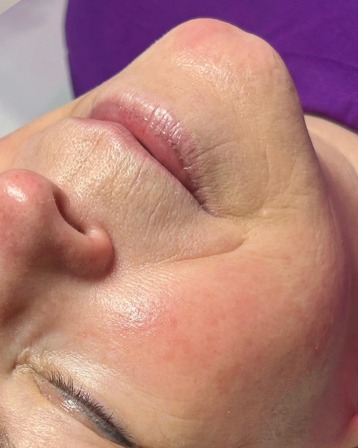 Dermaplaning Facial

See the instant glow! Dermaplaning gently removes dead skin, peach fuzz, buildup, and dull texture to reveal smoother, brighter, and softer skin.
It also helps with better product absorption and gives you a flawless makeup base.
