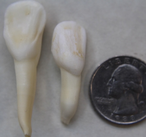 Buffalo Teeth