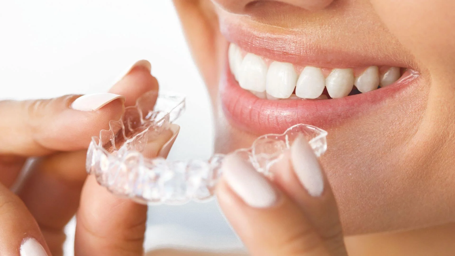 retainer.jpg