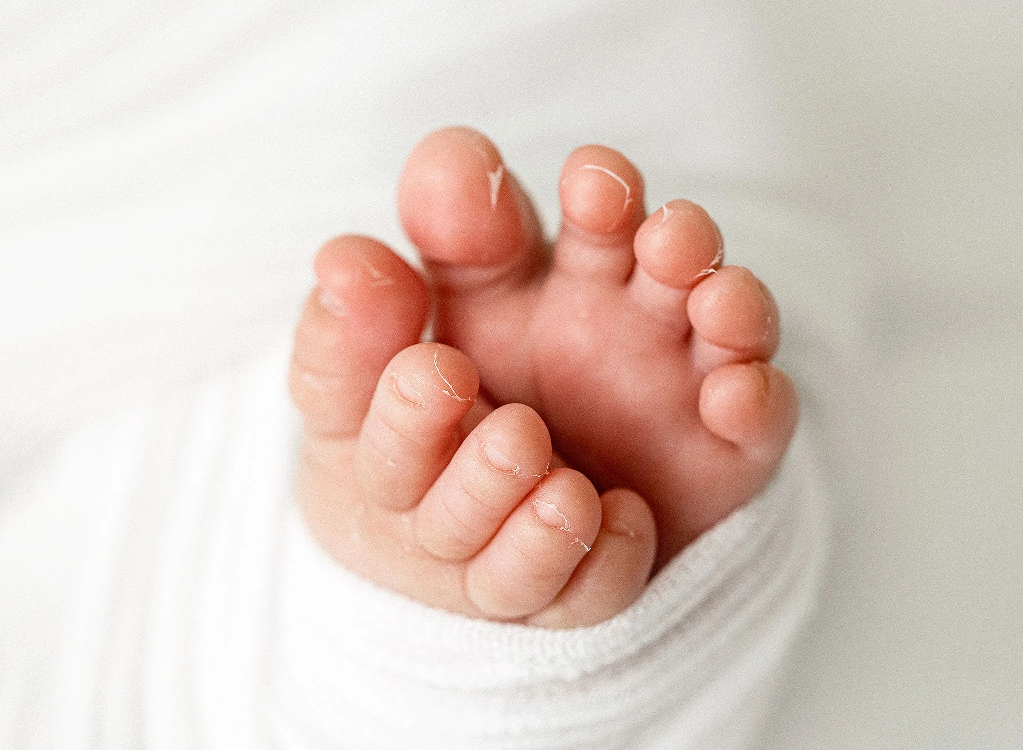 Close-up of a baby’s hand showing small fingers with peeling skin, wrapped in a white cloth.