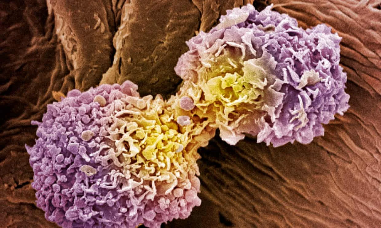 Australian researchers develop 10-minute cancer test