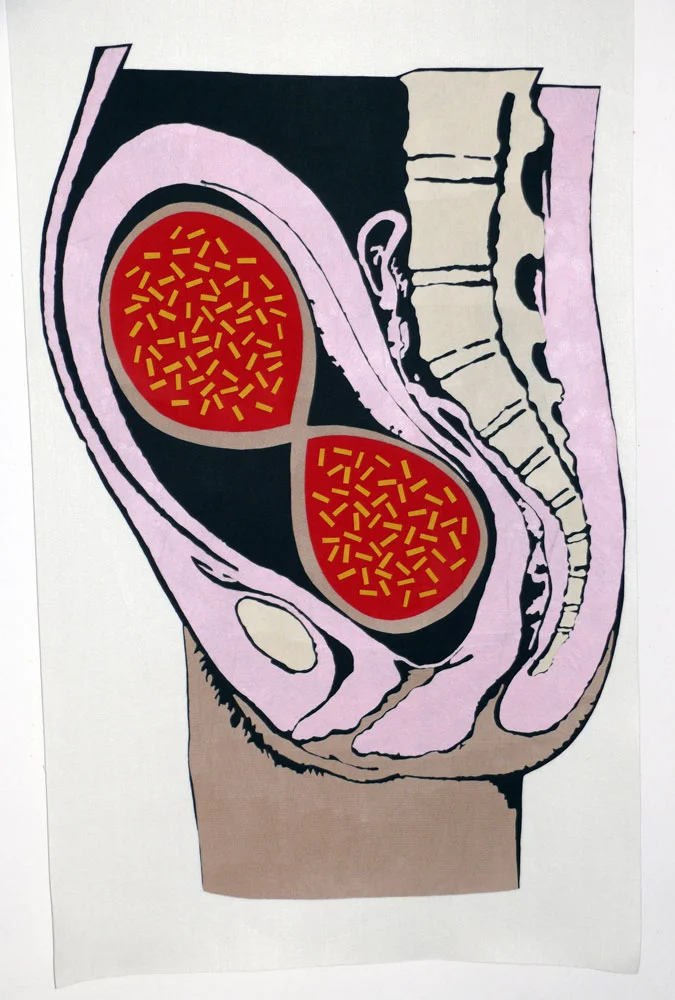 Pizza Infinity Pregnancy Complications, felt fabric banner. approximately 5ft x 3ft