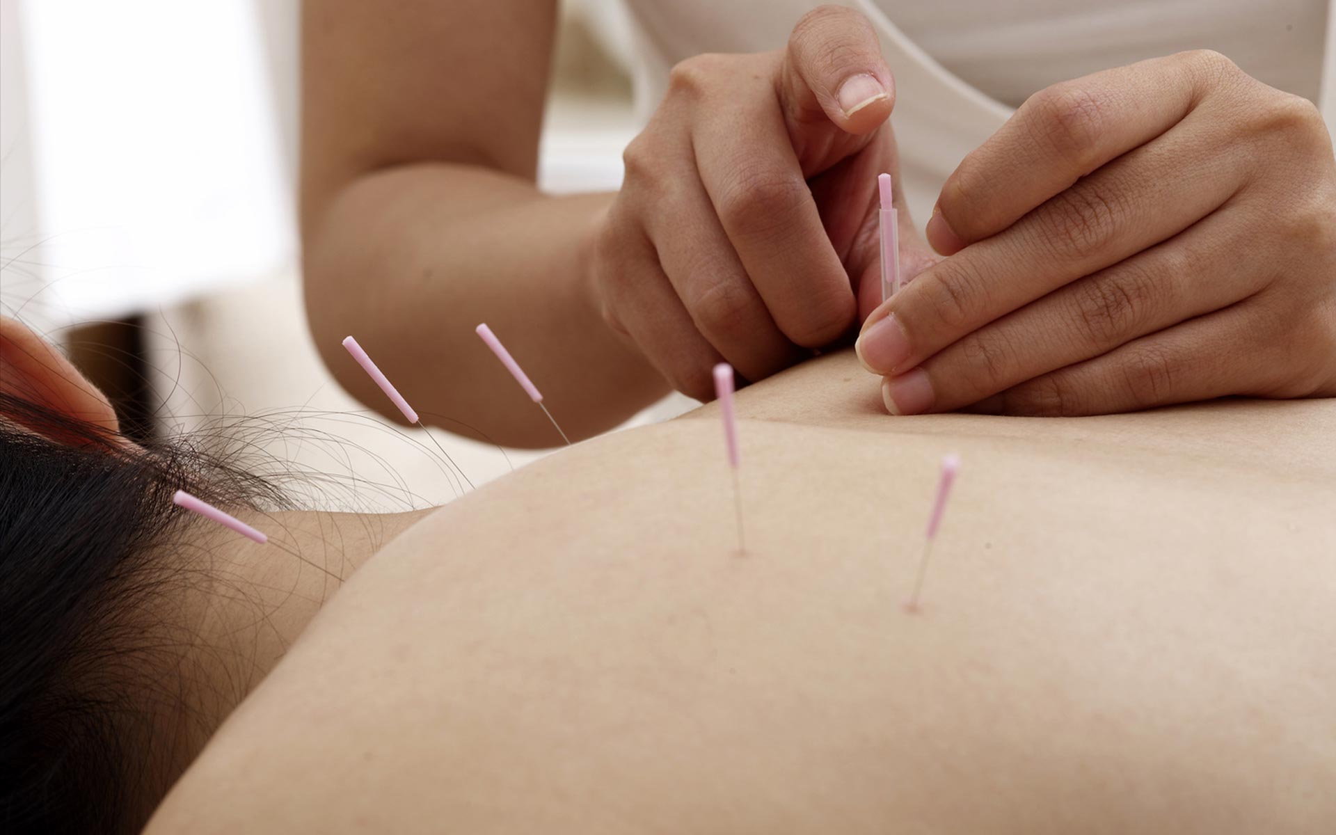 acupuncture.jpg