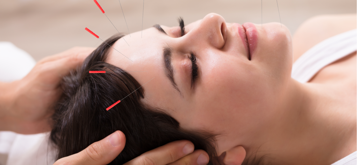 facial-acupuncture.png