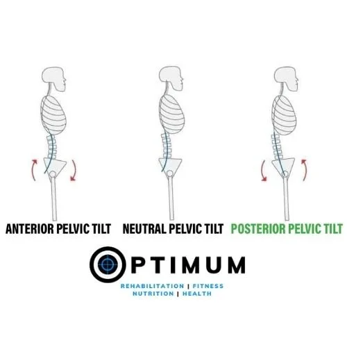 THE CAUSES OF ANTERIOR AND POSTERIOR PELVIC TILT