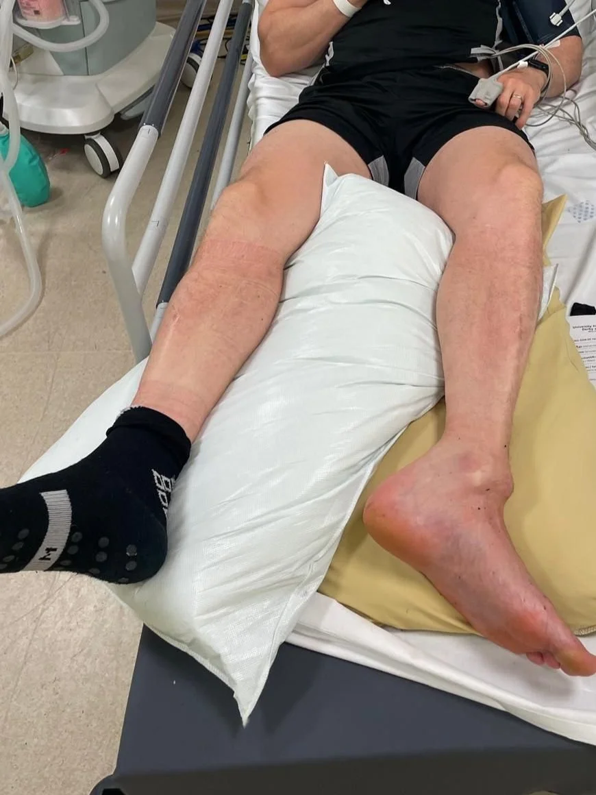 Our Unique Injury Rehab Process at Optimum Derby: Going Beyond Recovery