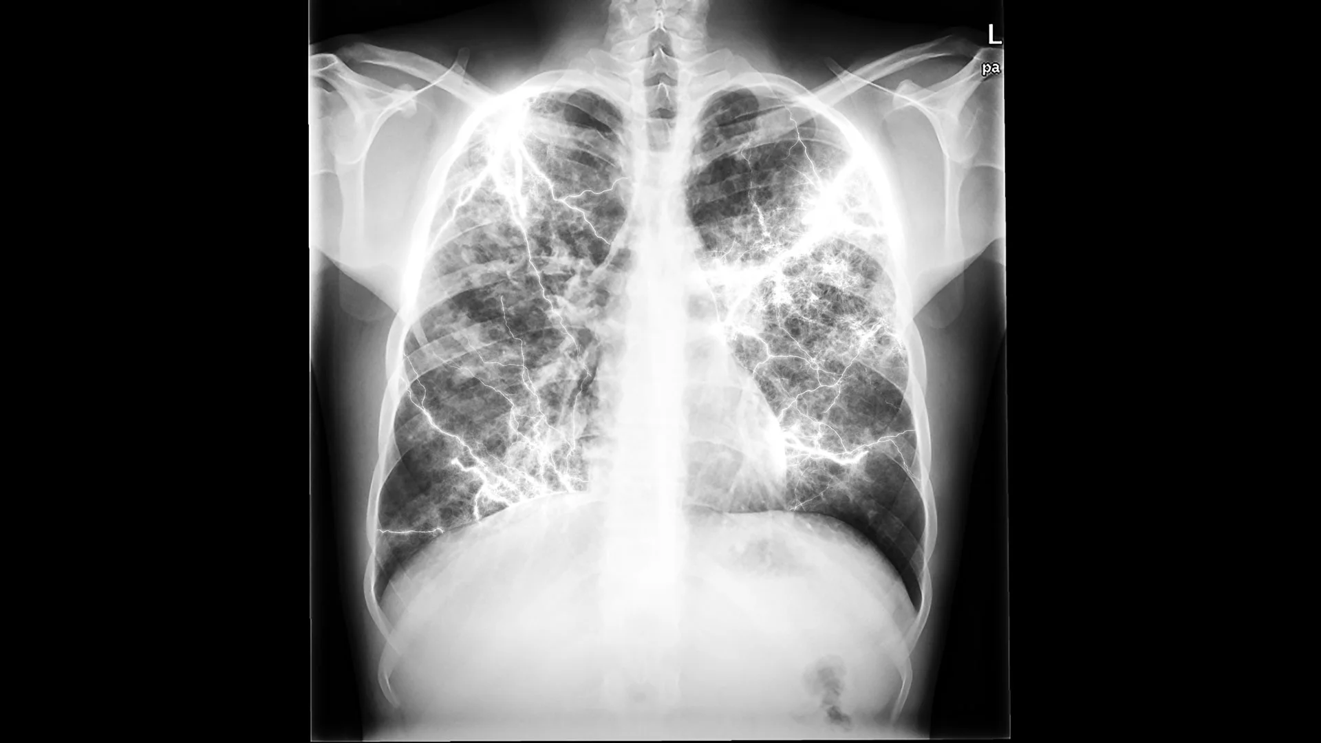 x_ray.jpg