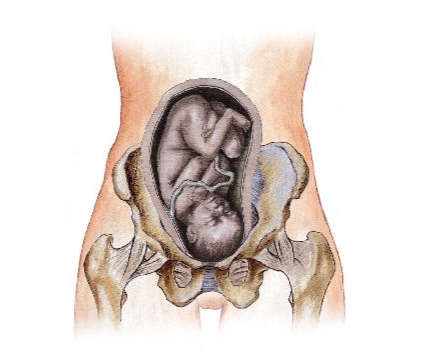 Pelvic Pain (Groin Pain), Pressure and Discomfort During Pregnancy