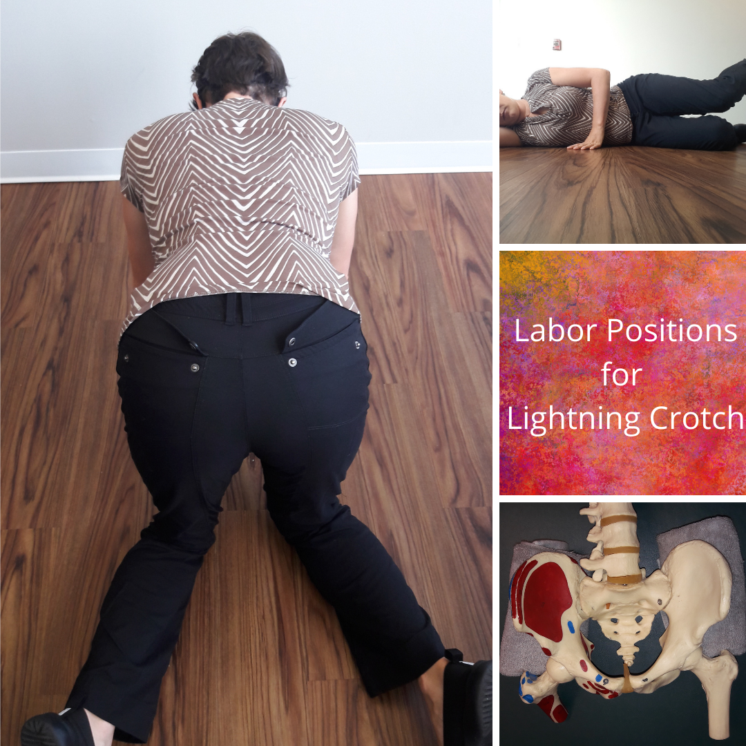 Pubic Symphysis Pain during Labor and Delivery — Dr. Lauren Keller