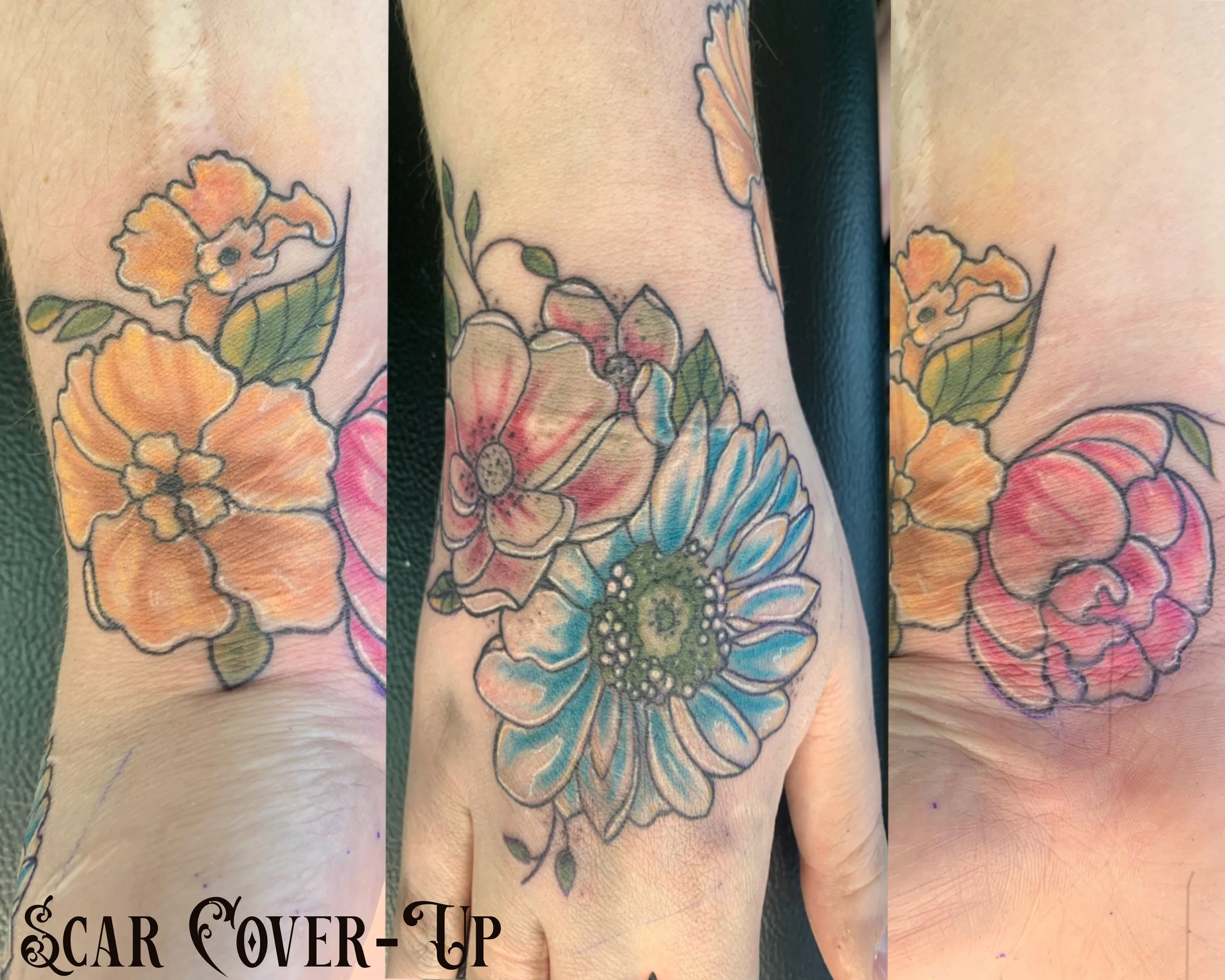 Scar Cover Up Tattoo Edmonton