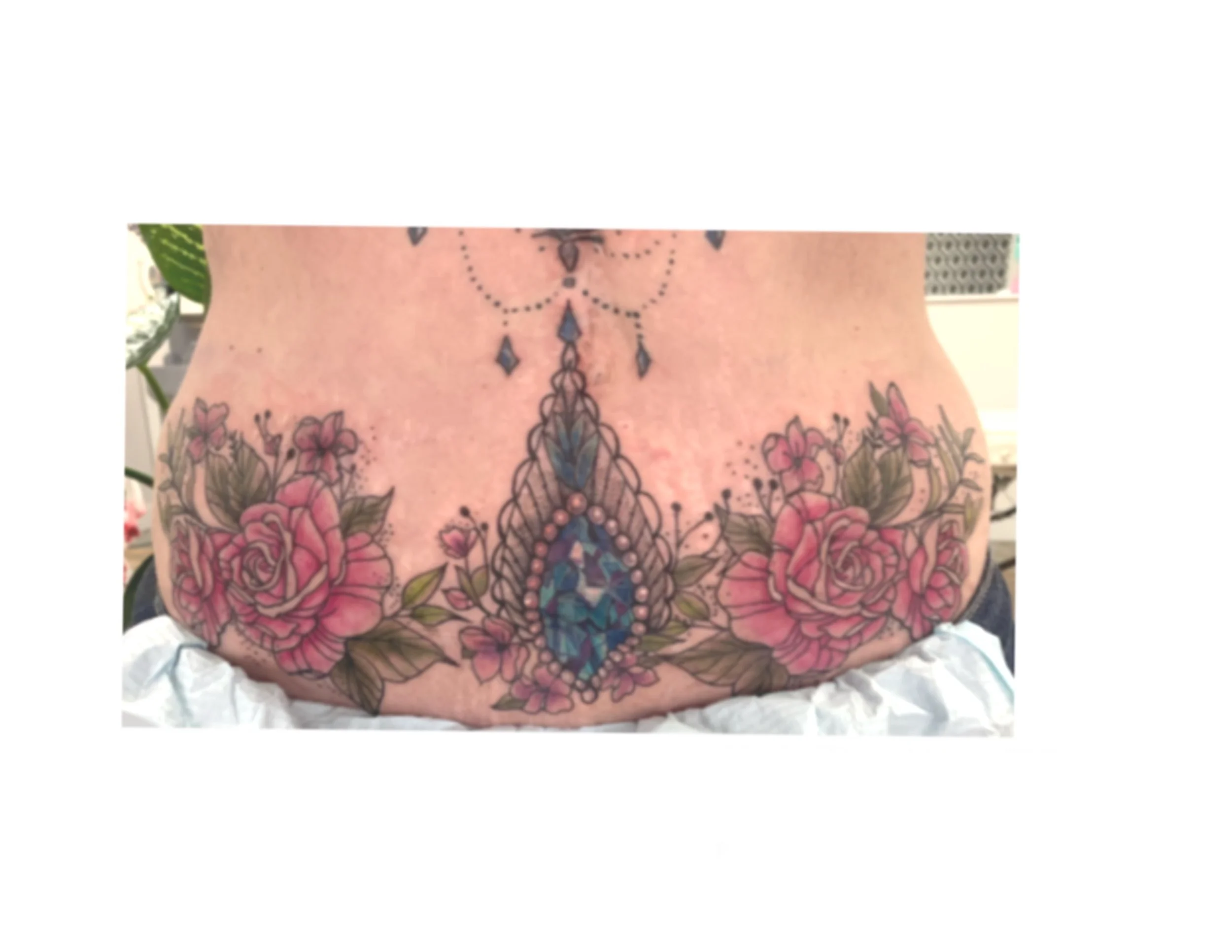 Scar Cover Up Tattoo Edmonton