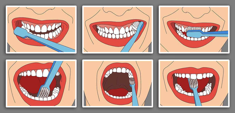 6 illustrated steps depicting how to correctly brush your teeth