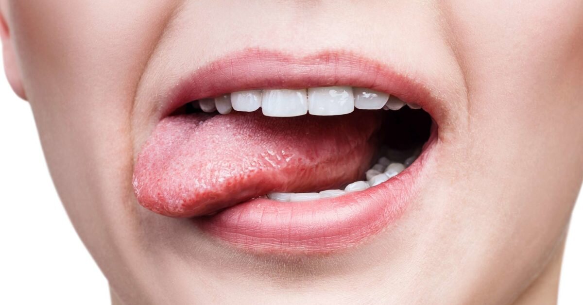 Pictures Of Early Signs Of Tongue Cancer - Infoupdate.org