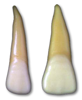 Lateral vs. Central Incisors