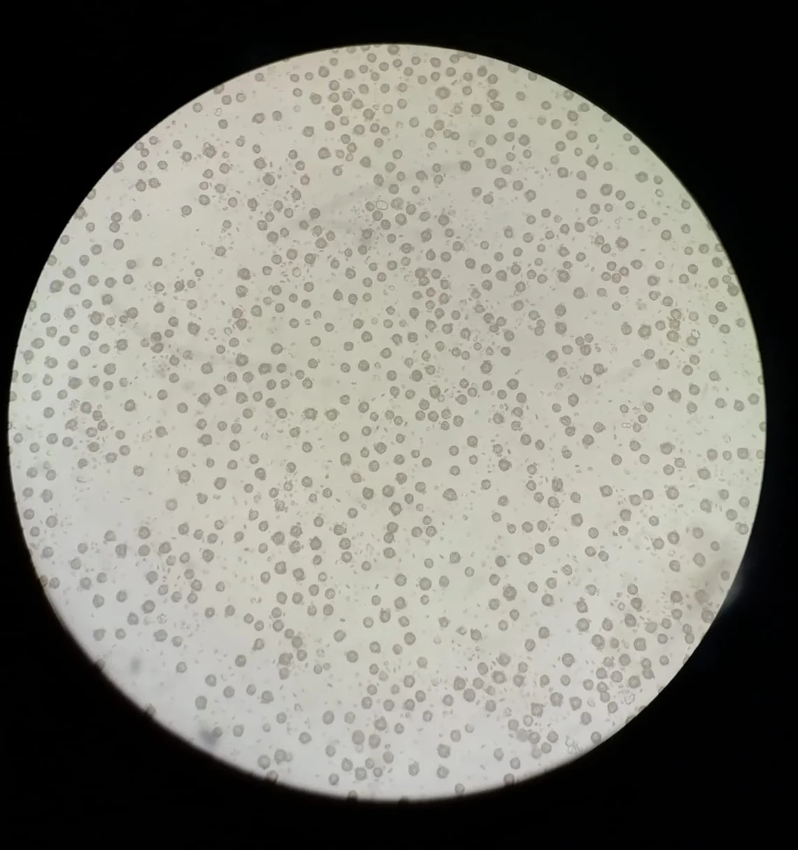 This is what a culture of Emiliania huxleyi looks like when seen under the microscope! This strain in particular was originally collected in the Caribbean Sea and cultured in standard K/2 medium under 24º C and low light conditions at the Roscoff Culture Collection (person. comun. Ian Probert, 2018).