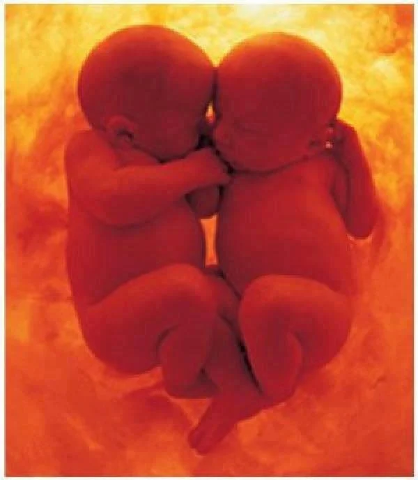 Identical Strangers