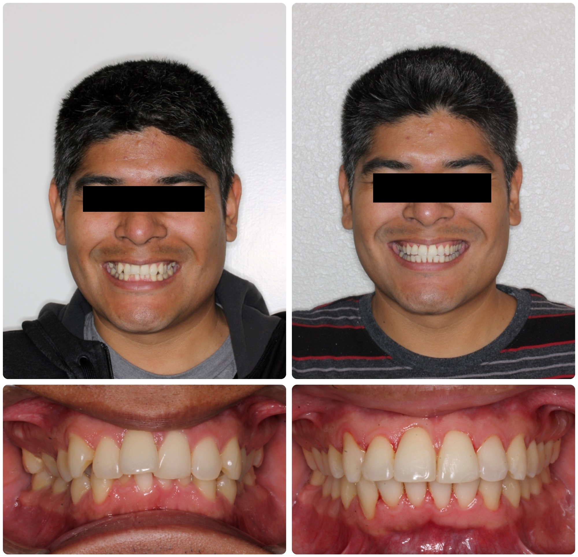 FL55-Before _ After.jpg
