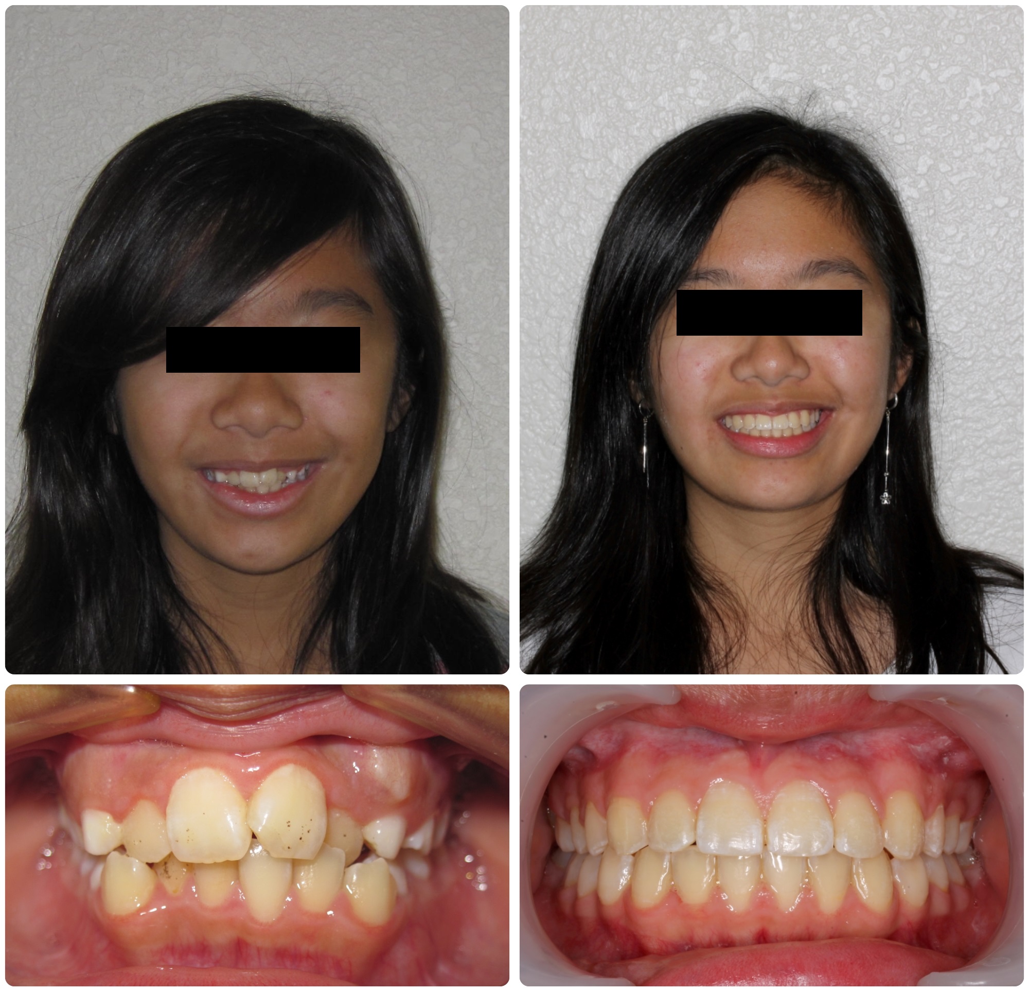 TR56-Before _ After.jpg