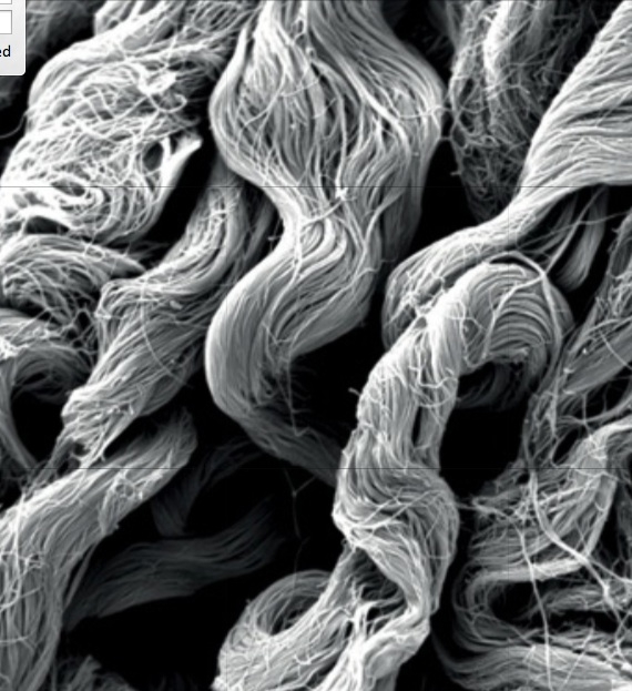 Jones lab: Scanning EM of collagen fibers