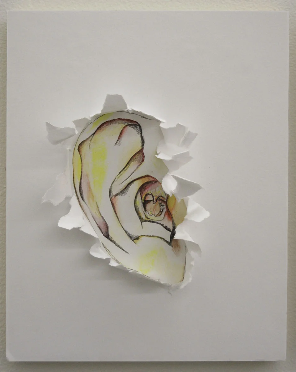 Ear-Ruptured eardum 2018 resized.jpg