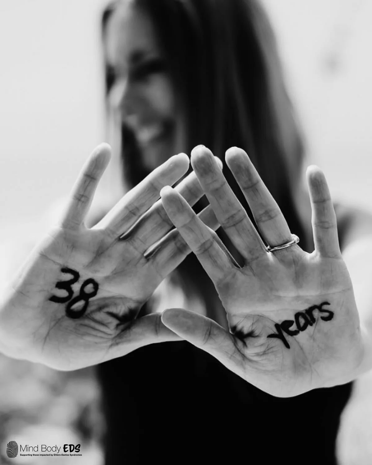 🩵🦓 MAY IS EDS &amp; HSD AWARENESS MONTH 🦓🩵

At @mindbodyedscharity we&rsquo;re continuing the #myEDSdiagnosis campaign - a powerful movement to raise awareness of the long journey many face to get diagnosed with Ehlers-Danlos Syndrome &amp; Hyper