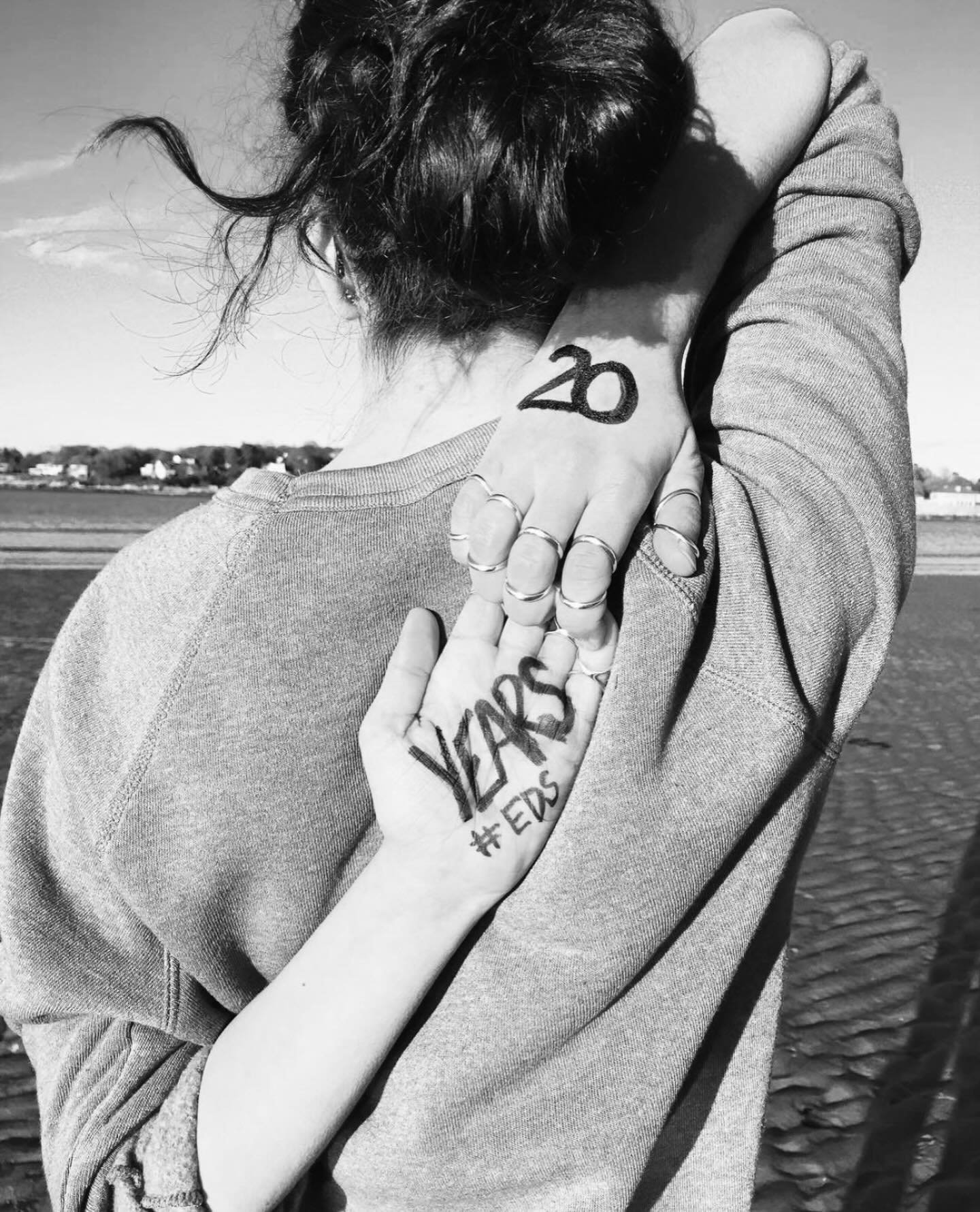 Every story matters. As part of our #myedsdiagnosis campaign, we&rsquo;re sharing journeys that reveal how long it can take to be diagnosed with EDS and HSD. Thank you @thewoollywarrior for sharing yours 🩵 -

&ldquo;It took 20 years of &ldquo;you ju