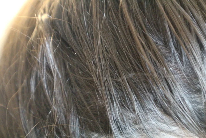 dove dermacare