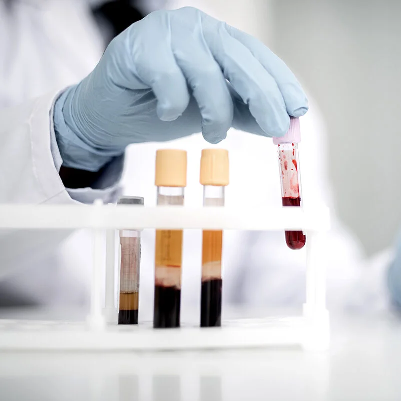 The Value of Lab Testing for Performance &amp; Recovery