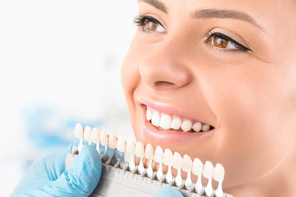 dental_veneers.jpg