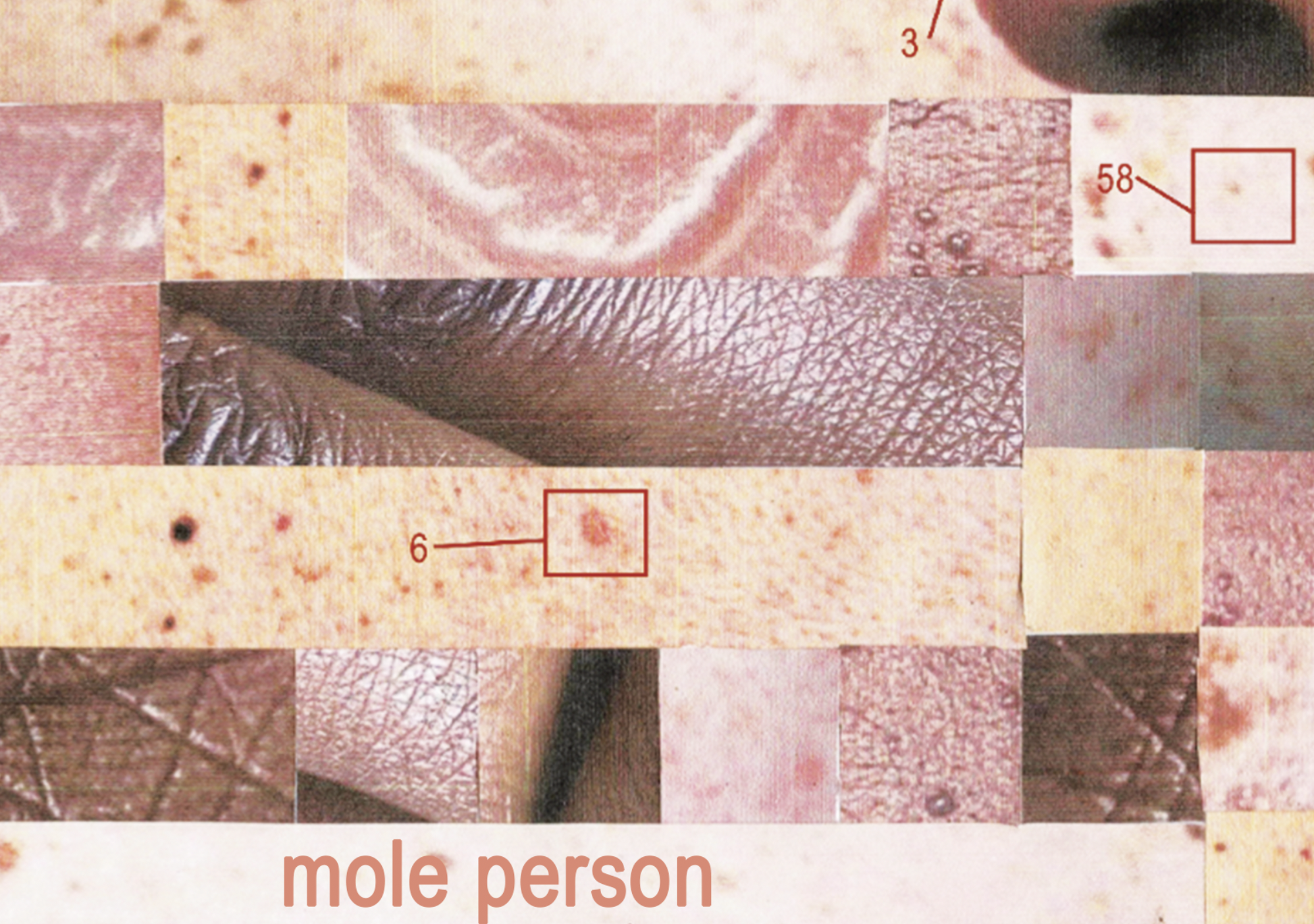 Mole Person
