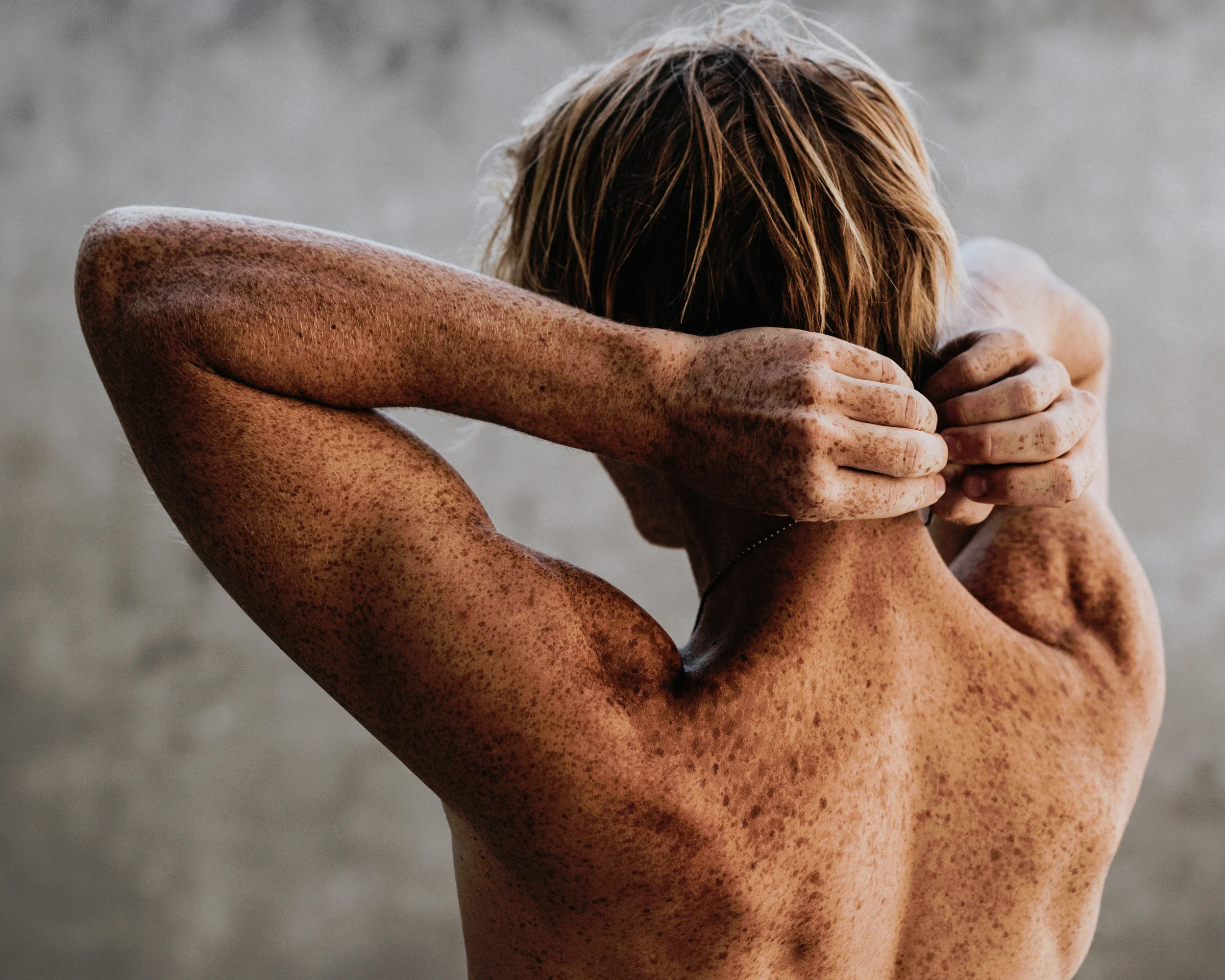 Znamienka a odstraňovanie kožných výrastkov