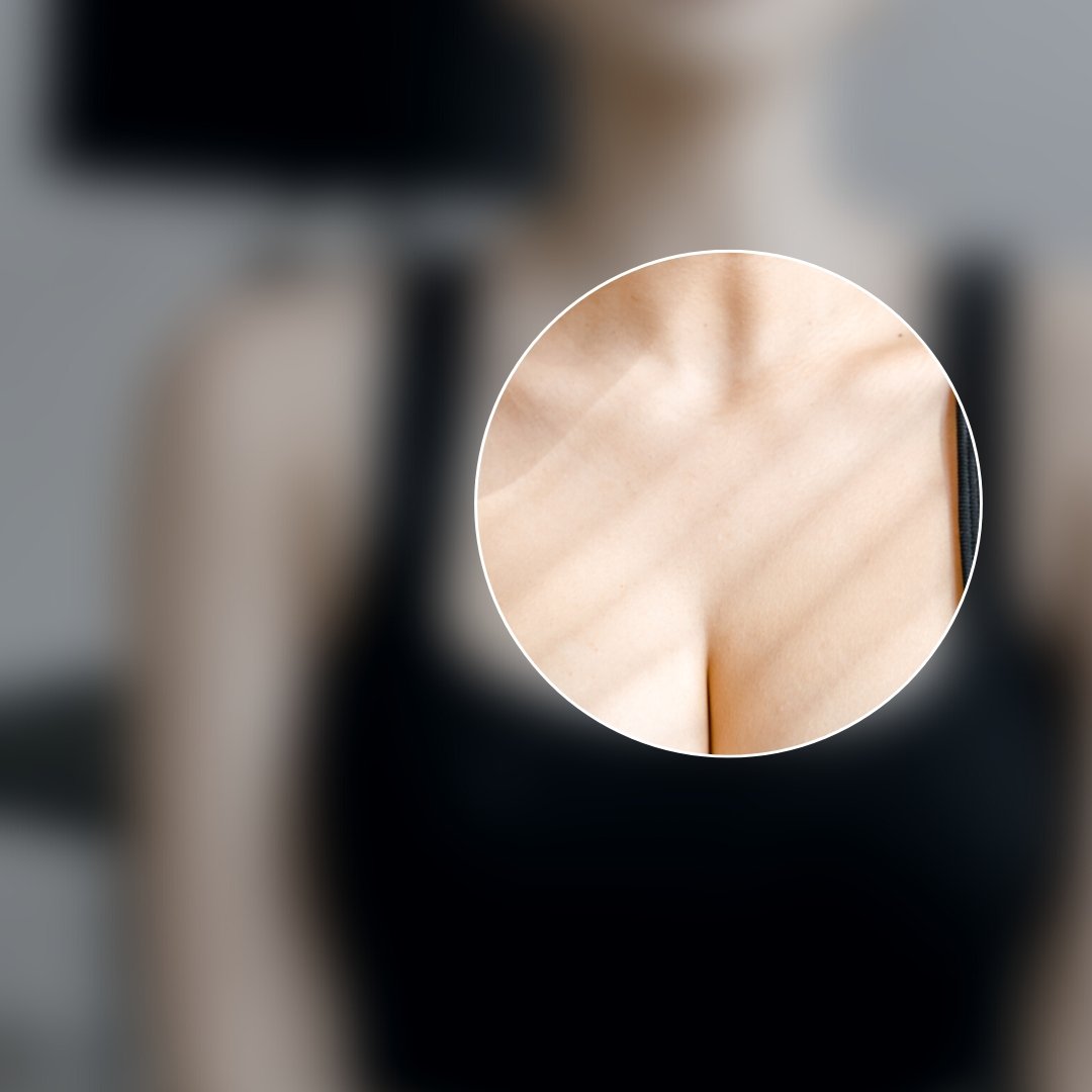 Estetické možnosti pre oblasť dekoltu