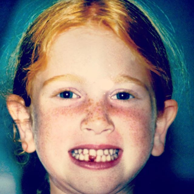 When I lost my first tooth! Or should I say, where it all began. #tbt